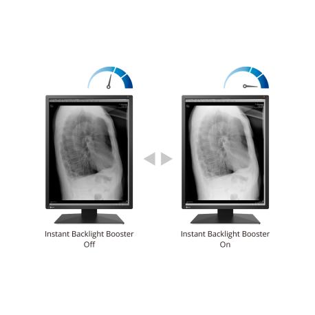 EIZO RadiForce RX270 - LCD monitor - 2MP - colour - 21.3" - 1200 x 1600 - IPS - 1000 cd / m² - 1800:1 - 20 ms - DVI-D, 2xDisplayPort - black - 9