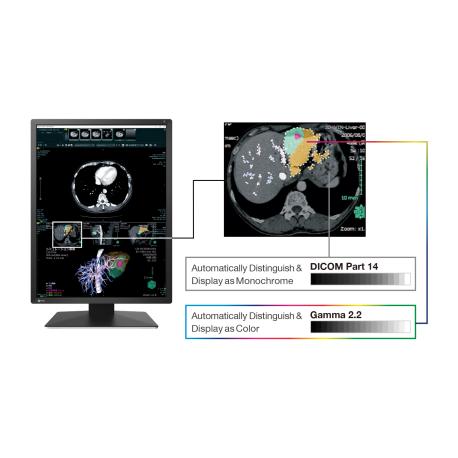 EIZO RadiForce RX270 - LCD monitor - 2MP - colour - 21.3" - 1200 x 1600 - IPS - 1000 cd / m² - 1800:1 - 20 ms - DVI-D, 2xDisplayPort - black - 5