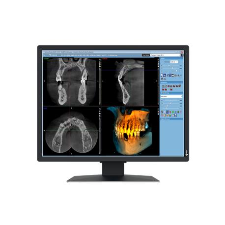 EIZO RadiForce MX217-SB - LED monitor - 2MP - colour - 21" - 1200 x 1600 - IPS - 500 cd / m² - 1800:1 - DVI-D, DisplayPort - black - 0